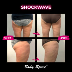2_SHOCKWAVE_ba_bodyspace